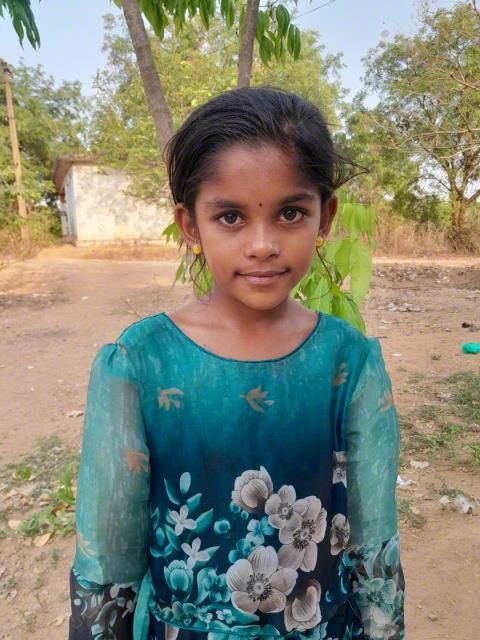 World Vision India